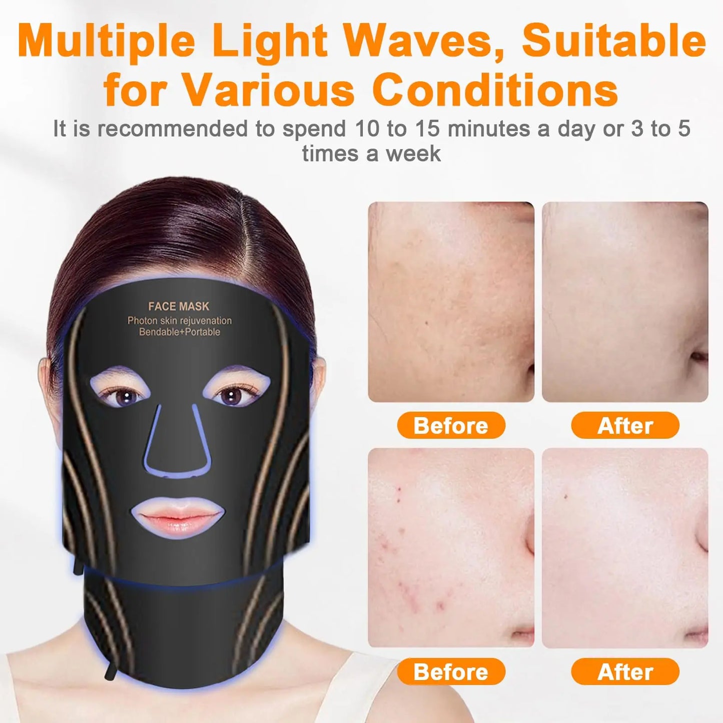 LumiTherapy LED Skin Device